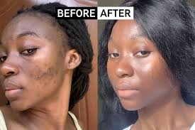Before and after transformation